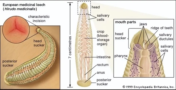 野外用河水洗了把臉：廣東男子鼻子里拽出5cm長水蛭！